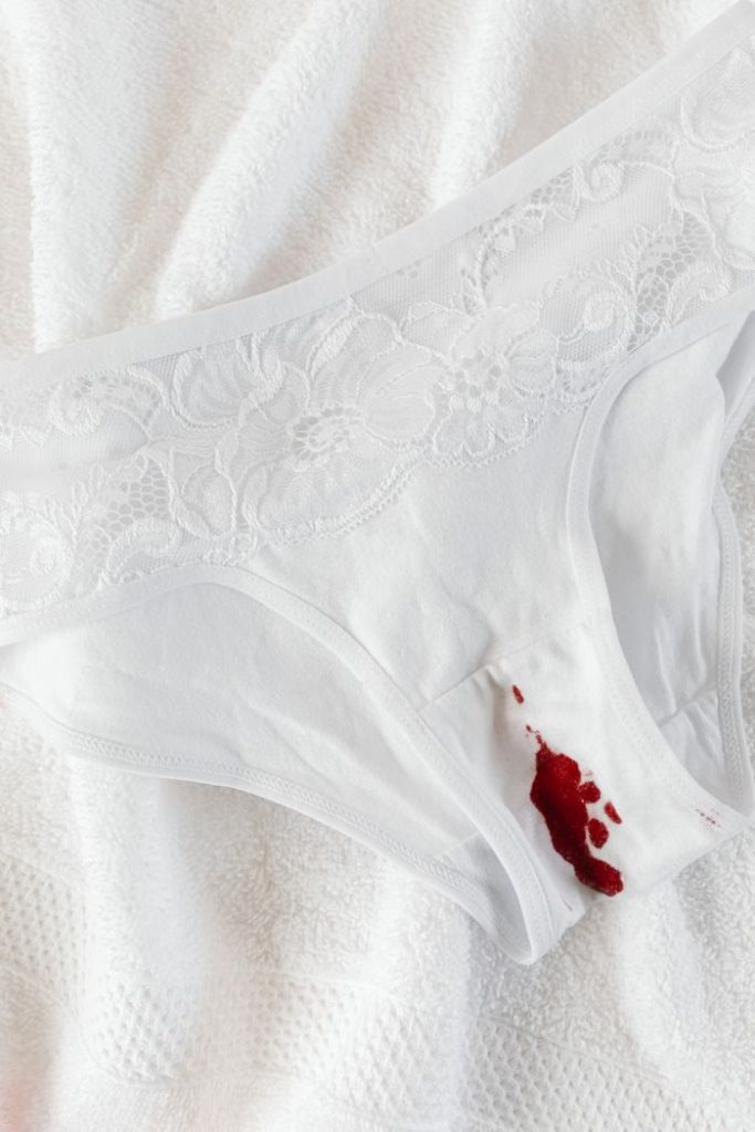 Close-up of white lace underwear with a menstrual blood stain on a towel.